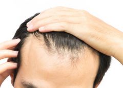 Sinpelo 240x172